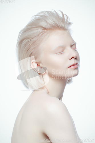 Image of beautiful albino ypung woman on white background