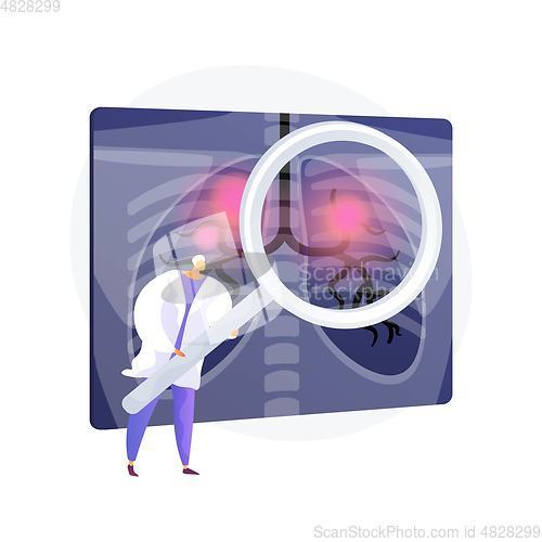 Image of Respiratory disease vector concept metaphor