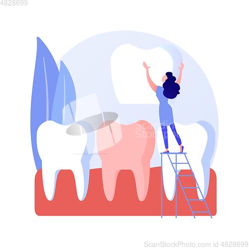 Image of Dental veneers abstract concept vector illustration.