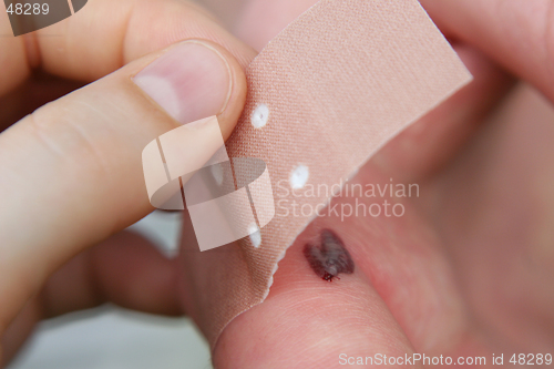 Image of Plaster and wound
