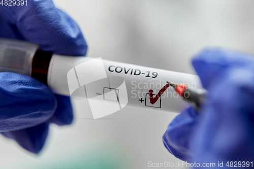 Image of hand holding beaker with coronavirus blood test