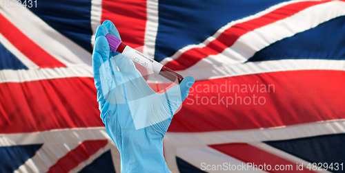 Image of hand holding beaker with coronavirus blood test