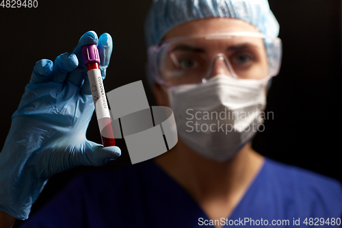 Image of doctor holding beaker with coronavirus blood test