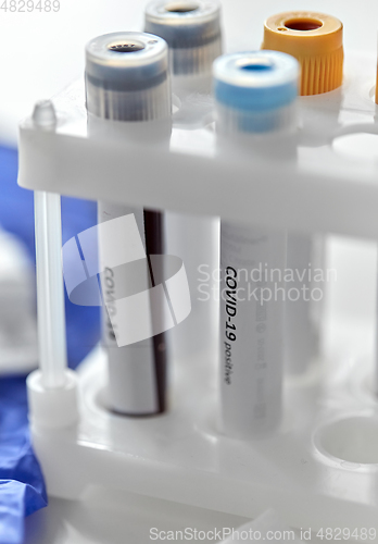 Image of beakers with coronavirus blood test in holder
