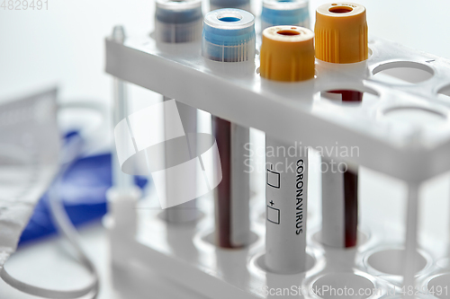 Image of beakers with coronavirus blood test in holder