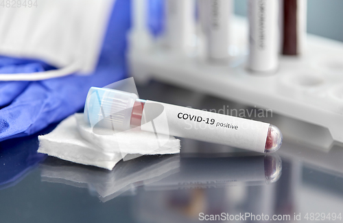 Image of beaker with coronavirus blood test at laboratory