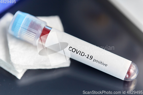 Image of beaker with coronavirus blood test at laboratory