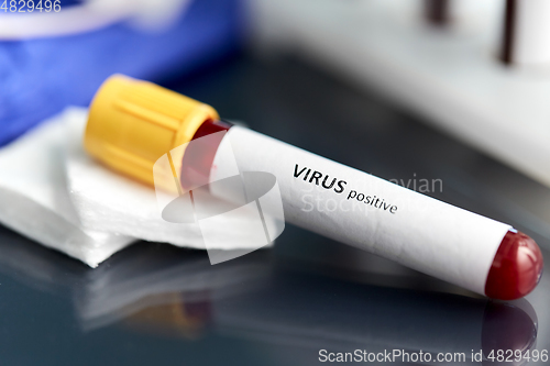 Image of beaker with virus blood test at laboratory