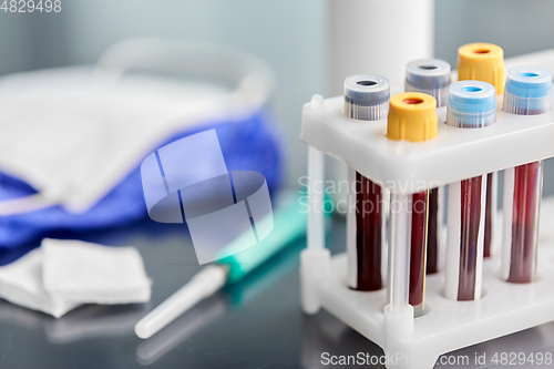 Image of beakers with blood tests, syringe, gloves and mask