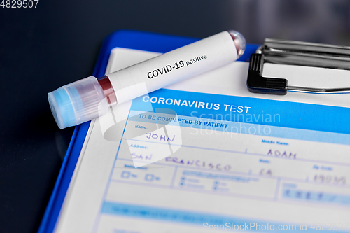 Image of close up of beaker with coronavirus blood test