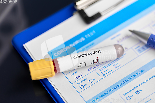 Image of close up of beaker with coronavirus blood test