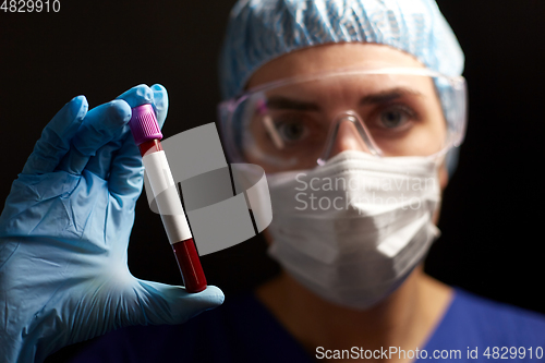 Image of close up of doctor holding beaker with blood test