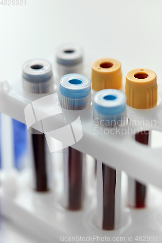 Image of beakers with coronavirus blood test in holder