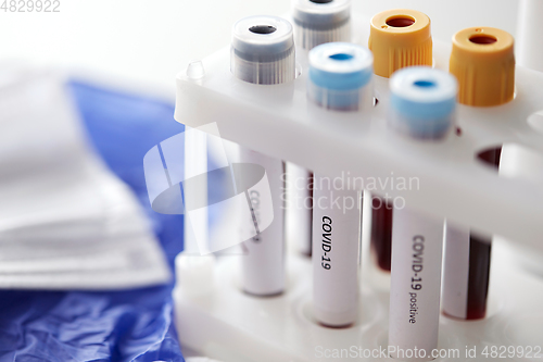 Image of beakers with coronavirus blood test in holder