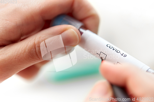 Image of hand holding beaker with coronavirus blood test