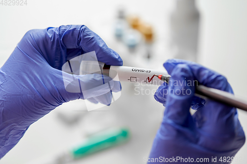 Image of hand holding beaker with coronavirus blood test