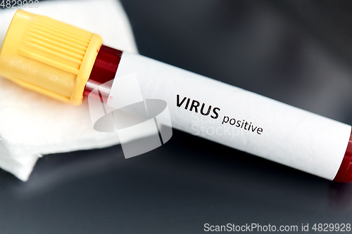 Image of beaker with virus blood test at laboratory