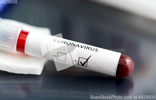 Image of beaker with coronavirus blood test at laboratory