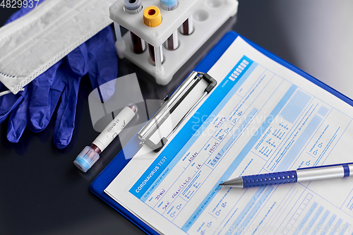 Image of beaker with coronavirus blood test at hospital