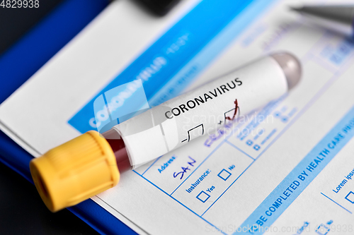 Image of close up of beaker with coronavirus blood test