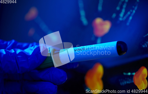 Image of hand holding beaker with coronavirus blood test