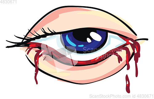 Image of Bloody eye of a woman Vector illustration
