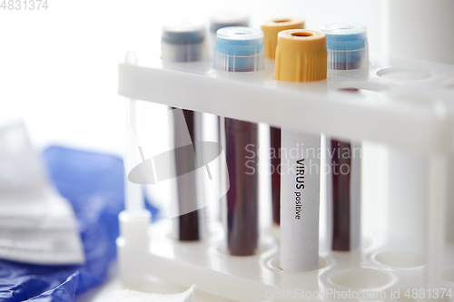 Image of beakers with coronavirus blood test in holder