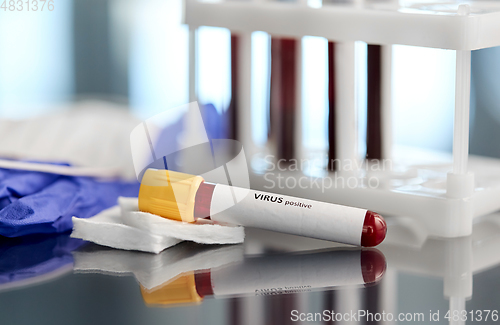 Image of beaker with virus blood test at laboratory