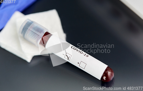 Image of beaker with coronavirus blood test at laboratory