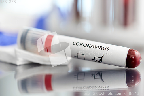 Image of beaker with coronavirus blood test at laboratory