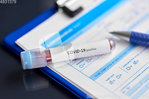 Image of close up of beaker with coronavirus blood test
