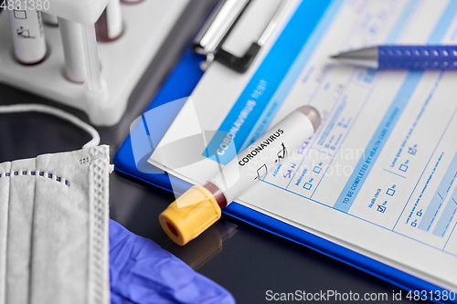 Image of beaker with coronavirus blood test at hospital