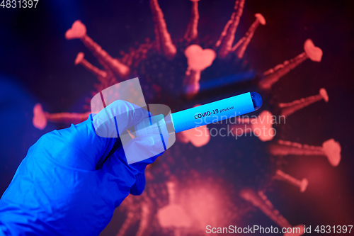 Image of hand holding beaker with coronavirus blood test