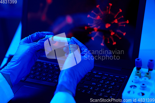 Image of hand holding beaker with coronavirus blood test