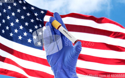 Image of hand holding beaker with positive virus blood test