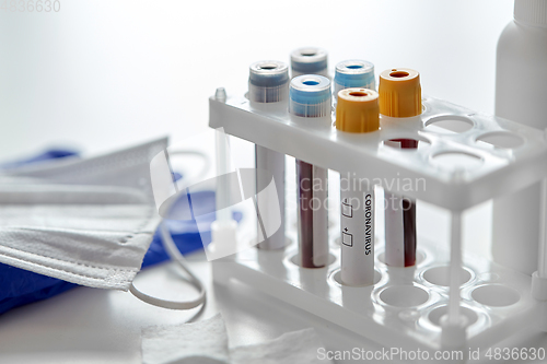 Image of beakers with coronavirus blood test in holder