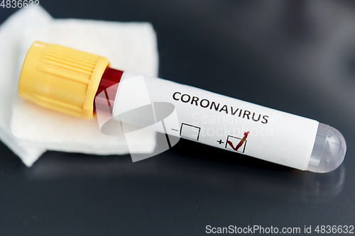 Image of beaker with coronavirus blood test at laboratory