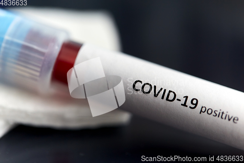 Image of beaker with coronavirus blood test at laboratory