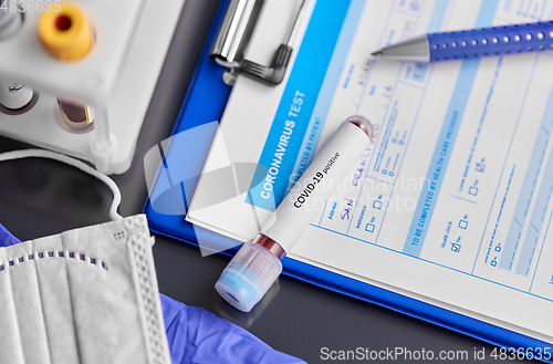 Image of beaker with coronavirus blood test at hospital