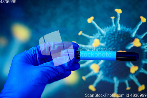 Image of hand holding beaker with coronavirus blood test