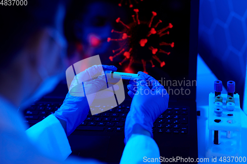Image of hand holding beaker with coronavirus blood test