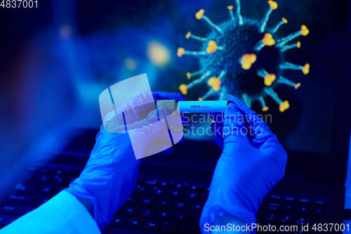 Image of hand holding beaker with coronavirus blood test