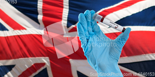 Image of hand holding beaker with coronavirus blood test