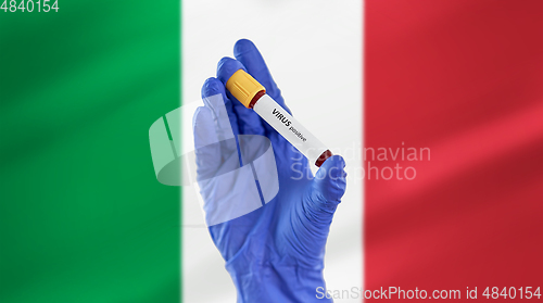 Image of hand holding beaker with positive virus blood test