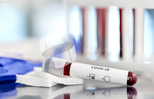 Image of beaker with coronavirus blood test at laboratory