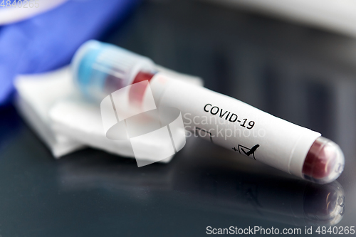 Image of beaker with coronavirus blood test at laboratory