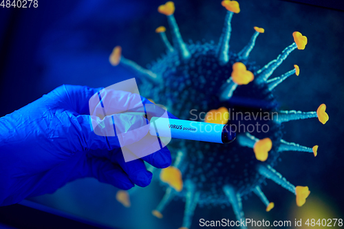 Image of hand holding beaker with coronavirus blood test