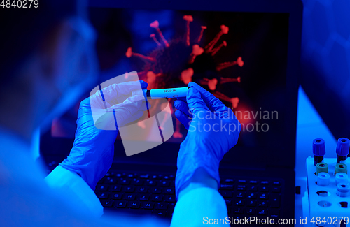 Image of hand holding beaker with coronavirus blood test