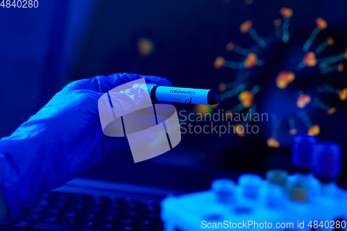 Image of hand holding beaker with coronavirus blood test