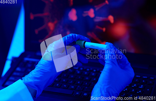 Image of hand holding beaker with coronavirus blood test